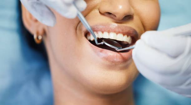 Best Weekend Emergency Dental Services in Mchenry, IL