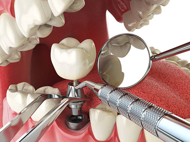Best Emergency Care for Gum Disease in Mchenry, IL